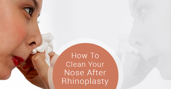 How To Clean Your Nose After Rhinoplasty 