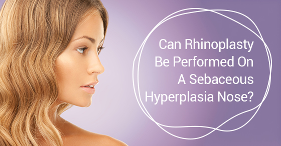 Can Rhinoplasty Be Performed On A Sebaceous Hyperplasia Nose?