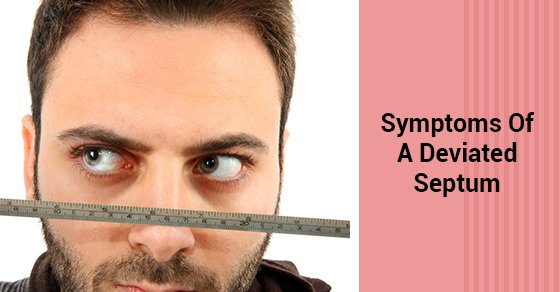 Symptoms Of A Deviated Septum