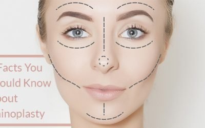 6 Facts You Need To Know About Rhinoplasty