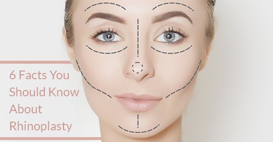 6 Facts You Need To Know About Rhinoplasty