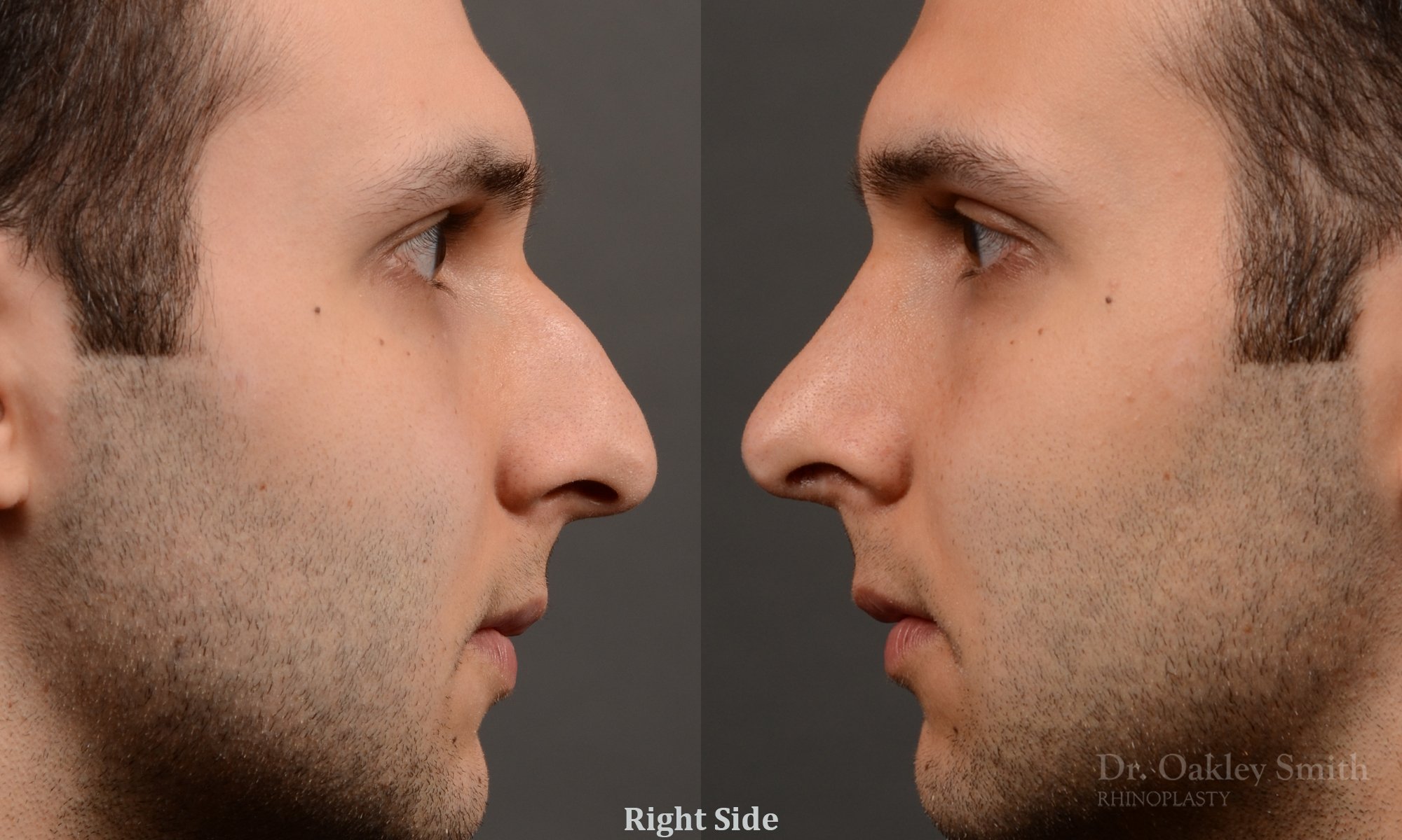 right profile side view