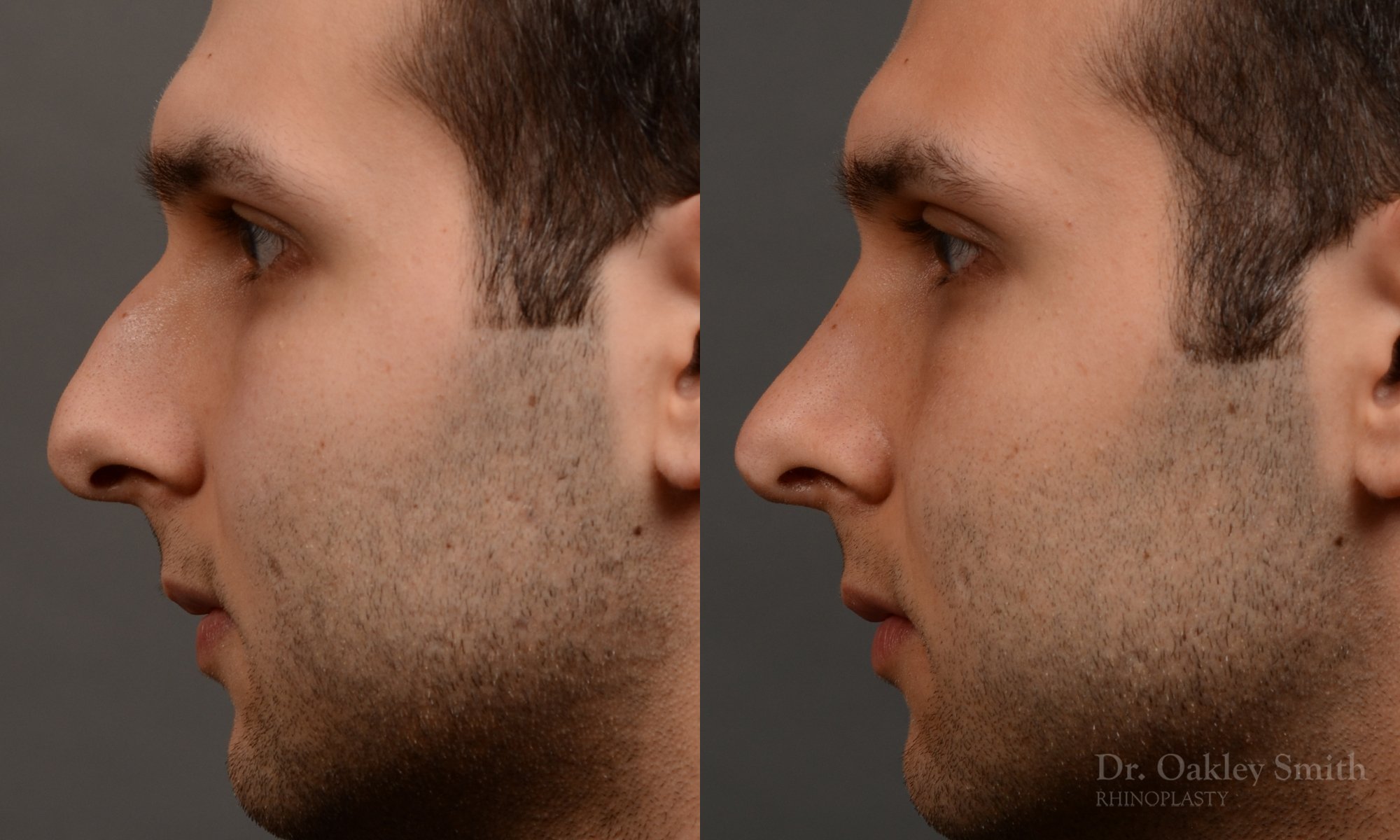left profile side view