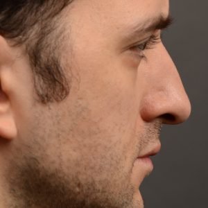 Dr. Oakley Smith accomplishes during his surgeries than a collection of before and after case
