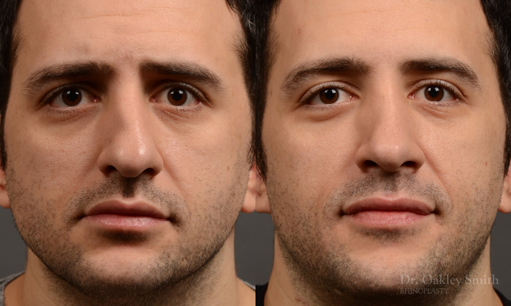 Dr. Oakley Smith accomplishes during his surgeries than a collection of before and after case