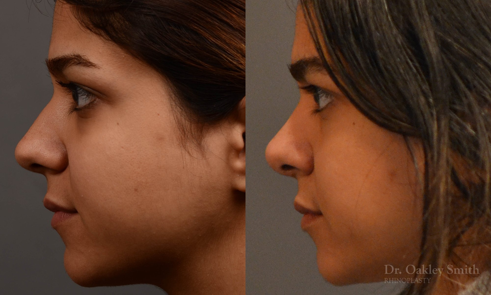 left profile view